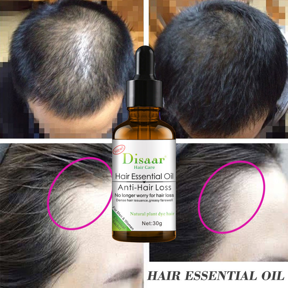 Hair Essential Massage Oil – 30ml