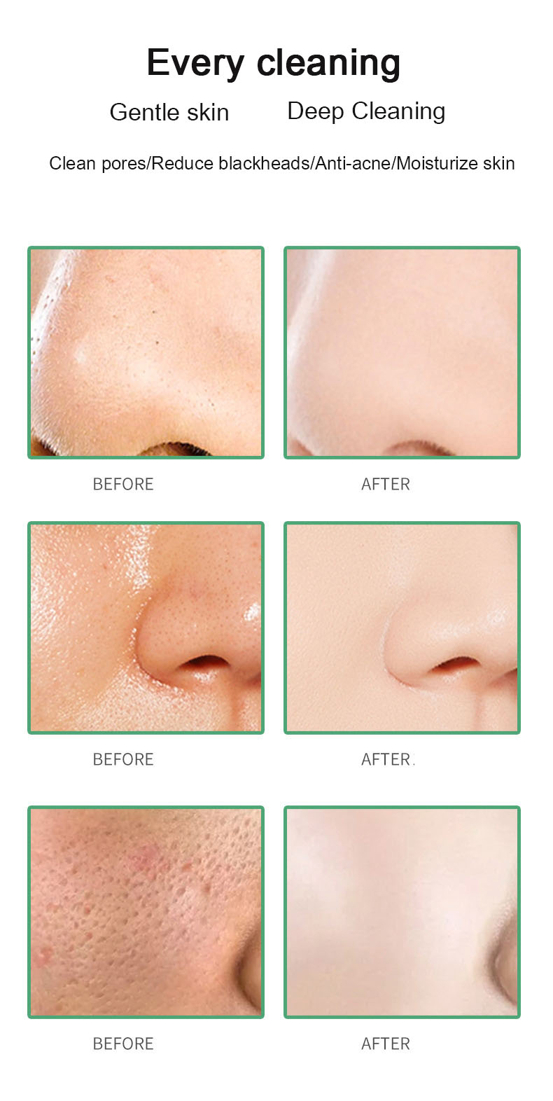 Green Tea Solid Clay Mask Stick – Blackhead Remover, Acne Treatment & Pore Shrinking Cleanser