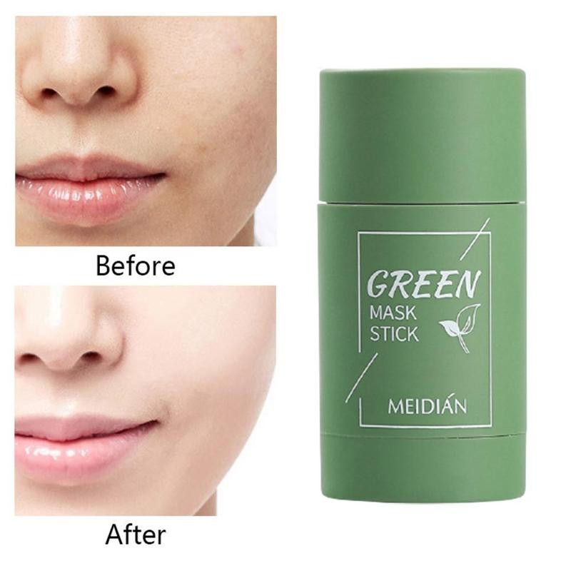 Green Tea Solid Clay Mask Stick – Blackhead Remover, Acne Treatment & Pore Shrinking Cleanser