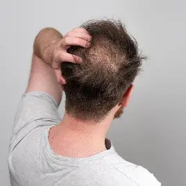 Hair BallEssence Be-Bodywise 3 Rosemary Hair Growth