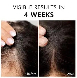 Hair BallEssence Be-Bodywise 3 Rosemary Hair Growth