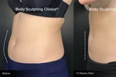 Sculpt Body Massager – Deep Tissue Muscle Relief & Slimming Vibrating Massager